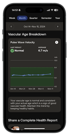 Withings Body Scan app showing vascular age breakdown with normal pulse wave velocity.